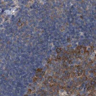 Immunohistochemistry-Paraffin: CDV3 Antibody [NBP1-81781] - Staining of human lymph node.
