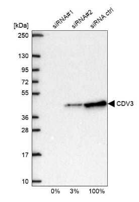 <b>Genetic Strategies Validation. </b>Western Blot: CDV3 Antibody [NBP1-81781] - Analysis in U2OS cells transfected with control siRNA, target specific siRNA probe #1 and #2, using anti-CDV3 antibody. Remaining relative intensity is presented.