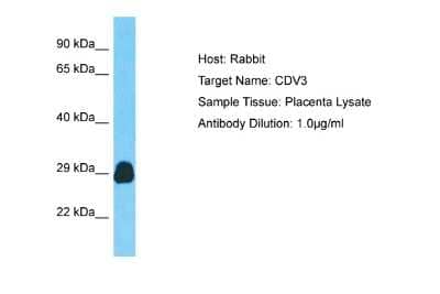Western Blot: CDV3 Antibody [NBP2-87167] - Host: Rabbit. Target Name: CDV3. Sample Type: Placenta lysates. Antibody Dilution: 1.0ug/ml