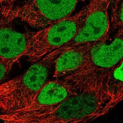 Immunocytochemistry/Immunofluorescence: CDX2 Antibody [NBP2-58280] - Staining of human cell line CACO-2 shows localization to nucleoplasm. Antibody staining is shown in green.