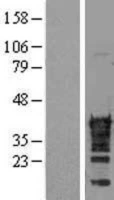 Western Blot CDX2 Overexpression Lysate