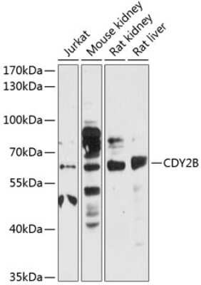 Western Blot: CDY2B Antibody [NBP3-05603] - Western blot analysis of extracts of various cell lines, using CDY2B antibody (NBP3-05603) at 1:3000 dilution. Secondary antibody: HRP Goat Anti-Rabbit IgG (H+L) at 1:10000 dilution. Lysates/proteins: 25ug per lane. Blocking buffer: 3% nonfat dry milk in TBST. Detection: ECL Basic Kit. Exposure time: 30s.