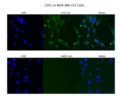 Immunocytochemistry/Immunofluorescence: CDYL Antibody [NBP1-52986] - Sample Type: MD MB231, Primary Antibody Dilution: 4 ug/ml
