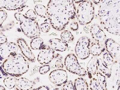 Immunohistochemistry-Paraffin: CDYL Antibody [NBP2-98669] - Immunochemical staining of human CDYL in human placenta with rabbit polyclonal antibody at 1:100 dilution, formalin-fixed paraffin embedded sections.