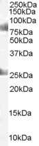 Western Blot: CDYL Antibody [NB300-874] - (1ug/ml) of Human Testes lysate (RIPA buffer, 35ug total protein per lane). Primary incubated for 1 hour. Detected by western blot using chemiluminescence.