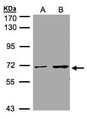 Western Blot: CDYL Antibody [NBP1-31036] - Sample(30 ug of whole cell lysate)A:A431 B:H12997. 5% SDS PAGE, antibody diluted at 1:1000.