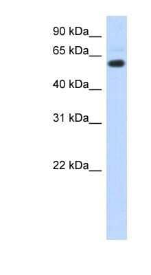 Western Blot: CDYL Antibody [NBP1-52986] - Transfected 293T cell lysate, concentration 0.2-1 ug/ml.
