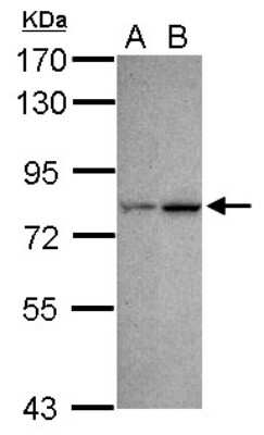 Western Blot CDYL Antibody