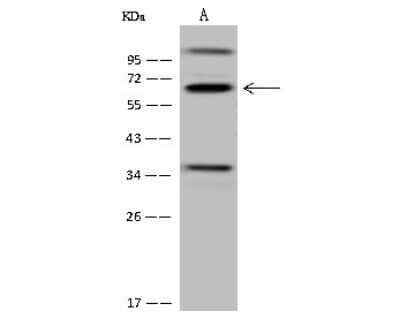 Western Blot CDYL Antibody