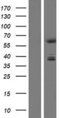 Western Blot CDYL Overexpression Lysate