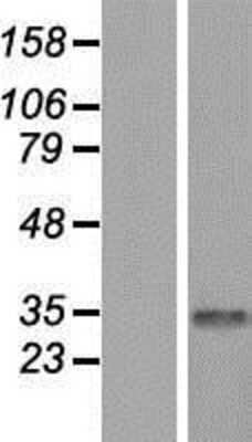 Western Blot CDYL Overexpression Lysate