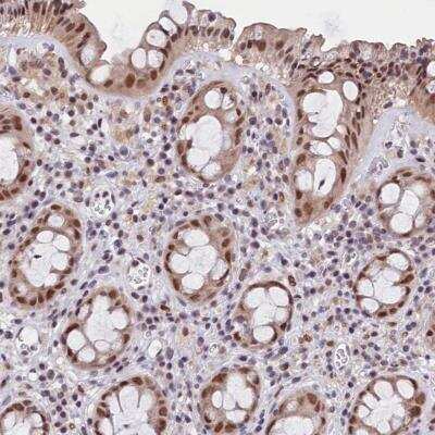 Immunohistochemistry: CDYL2 Antibody [NBP1-83470] - Immunohistochemical staining of human rectum shows moderate nuclear positivity in glandular cells.