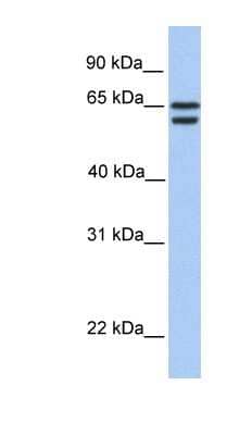 Western Blot: CDYL2 Antibody [NBP1-55178] - 721_B cell lysate, concentration 0.2-1 ug/ml.
