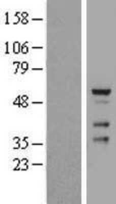 Western Blot: CDYL2 Overexpression Lysate (Adult Normal) [NBP2-05387] Left-Empty vector transfected control cell lysate (HEK293 cell lysate); Right -Over-expression Lysate for CDYL2.