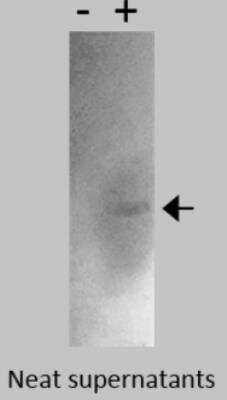 Western Blot: CEACAM-19 Antibody (Z5P2D9*A9) [NBP2-53124] - Cell lysates probed with Anti-CEACAM19 [Z5P2D9*A9]. CEACAM19 overexpression lysate from NBP2-06675.