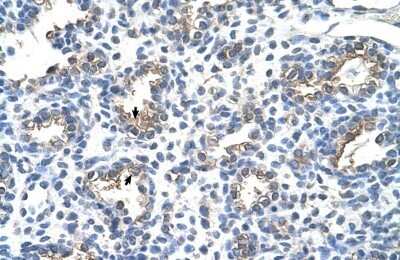 Immunohistochemistry-Paraffin: CEACAM-6/CD66c Antibody [NBP1-55290] - Human Lung Alveolar cells (indicated with arrows), 4-8ug/ml.