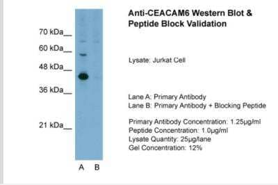 Western Blot: CEACAM-6/CD66c Antibody [NBP1-55290] - Sample Tissue: Jurkat, Lane A: Primary Antibody, Lane B: Primary Antibody + Blocking Peptide, Primary Antibody Concentration: 1.25ug/mL, Peptide Concentration: 1.0ug/mL, Lysate Quantity: 25ug/lane, Gel Concentration: 12%