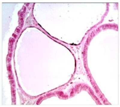 Immunohistochemistry: CEACAM1/CD66a Antibody (11-1H) [NBP2-59674] - IHC