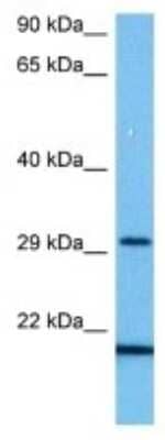 Western Blot: CEACAM10 Antibody [NBP3-10158] - Western blot analysis of CEACAM10 in Mouse Small Intestine lysates. Antibody dilution at 1ug/ml