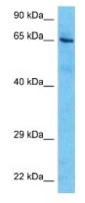 Western Blot: CEACAM20 Antibody [NBP3-09600] - Western blot analysis of CEACAM20 in THP-1 Whole Cell lysates. Antibody dilution at 1.0ug/ml