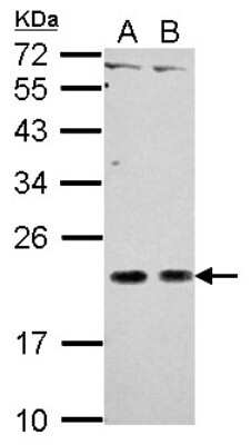 Western Blot: CEACAM21 Antibody [NBP2-15853] - Sample (30 ug of whole cell lysate) A: NT2D1 B: PC-3 12% SDS PAGE gel, diluted at 1:500.