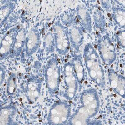 Immunohistochemistry-Paraffin: CEACAM3 Antibody [NBP1-85743] - Staining of human duodenum shows strong cytoplasmic positivity in a subset of leukocytes.