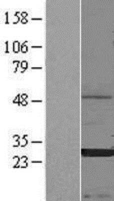 Western Blot: CEACAM3 Overexpression Lysate (Native) [NBP2-10774] - CEACAM3 Overexpression Lysate (Native) Left-Empty vector transfected control cell lysate (HEK293 cell lysate); Right -Over-expression Lysate for Carcino Embryonic Antigen CEA.