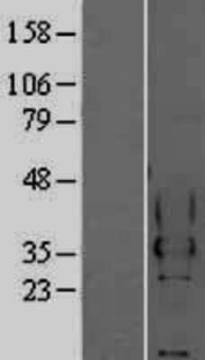 Western Blot: CEACAM4 Overexpression Lysate (Adult Normal) [NBP2-04208] Left-Empty vector transfected control cell lysate (HEK293 cell lysate); Right -Over-expression Lysate for CEACAM4.