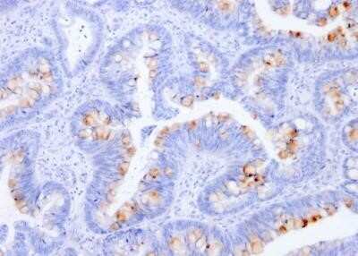 Immunohistochemistry-Paraffin: CEACAM5/CD66e Antibody (C66/1291) - Azide and BSA Free [NBP2-54429] - Human Colon stained with CEACAM5/CD66e Antibody (C66/1291).