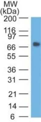 Western Blot: CEACAM5/CD66e Antibody (COL-1) - Azide and BSA Free [NBP3-05767] - Western Blot: CEACAM5/CD66e Antibody (COL-1) - Azide and BSA Free - Western Blot analysis of human stomach lysate.