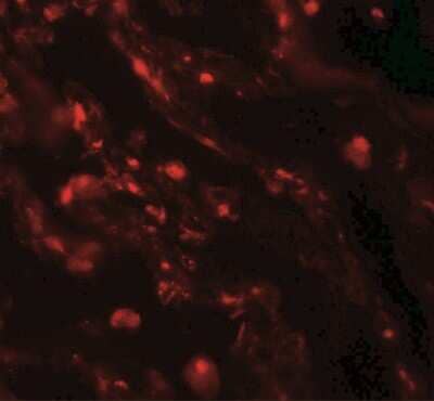 Immunohistochemistry: CEACAM5/CD66e Antibody [NBP2-41231] - Immunofluorescence of CEACAM5 in human lung tissue with CEACAM5 antibody at 20 ug/mL.