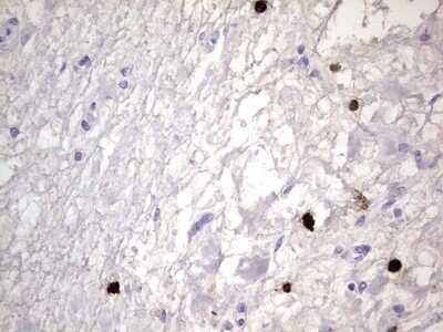 Immunohistochemistry: CEACAM5/CD66e Antibody (OTI3D8) - Azide and BSA Free [NBP2-70407] - Analysis of Human bladder tissue.