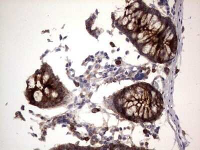 Immunohistochemistry: CEACAM5/CD66e Antibody (OTI3D8) - Azide and BSA Free [NBP2-70407] - Analysis of Human colon tissue.