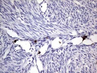 Immunohistochemistry: CEACAM5/CD66e Antibody (OTI3D8) - Azide and BSA Free [NBP2-70407] - Analysis of Human endometrium tissue.
