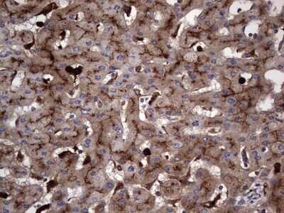 Immunohistochemistry: CEACAM5/CD66e Antibody (OTI3D8) - Azide and BSA Free [NBP2-70407] - Analysis of Human liver tissue.