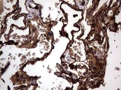 Immunohistochemistry: CEACAM5/CD66e Antibody (OTI3D8) - Azide and BSA Free [NBP2-70407] - Analysis of Human lung tissue.