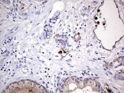 Immunohistochemistry: CEACAM5/CD66e Antibody (OTI3D8) - Azide and BSA Free [NBP2-70407] - Analysis of Human prostate tissue.