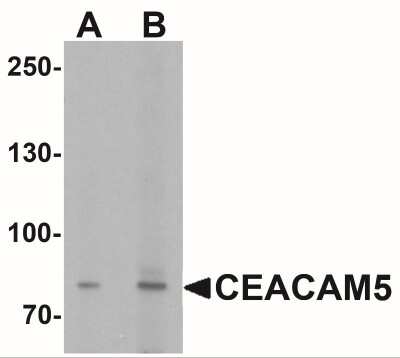 Western Blot: CEACAM5/CD66e Antibody [NBP2-41231] - Analysis of CEACAM5 in rat lung tissue lysate with CEACAM5 antibody at  (A) 1 and (B) 2 ug/ml.