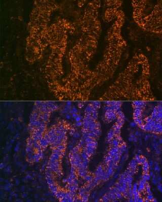 Immunocytochemistry/Immunofluorescence: CEACAM6/CD66c Antibody (4Z3V7) [NBP3-16625] - Immunofluorescence analysis of human colon carcinoma cells using CEACAM6/CD66c Rabbit mAb (NBP3-16625) at dilution of 1:100 (40x lens). Blue: DAPI for nuclear staining.