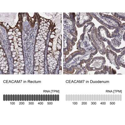 Immunohistochemistry-Paraffin: CEACAM7 Antibody [NBP3-17026] - Analysis in human rectum and duodenum tissues using Anti-CEACAM7 antibody. Corresponding CEACAM7 RNA-seq data are presented for the same tissues.