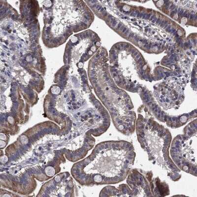 Immunohistochemistry-Paraffin: CEACAM7 Antibody [NBP3-17026] - Staining of human duodenum shows low expression as expected.