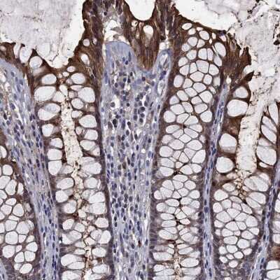 Immunohistochemistry-Paraffin: CEACAM7 Antibody [NBP3-17026] - Staining of human rectum shows high expression.