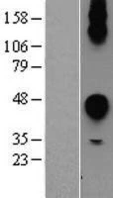 Western Blot: CEACAM7 Overexpression Lysate (Adult Normal) [NBP2-04321] Left-Empty vector transfected control cell lysate (HEK293 cell lysate); Right -Over-expression Lysate for CEACAM7.