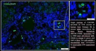 Immunohistochemistry: CEACAM8/CD66b Antibody (G10F5) - Azide and BSA Free [NBP2-80664] - Staining of CD66b on FFPE section of human liver. Secondary Antibody is A488 goat anti-mouse IgM. CD66b is shown in green and DAPI in blue. Cells exhibit a morphology that correspond to neutrophils with segmented nuclei. The CD66b Ab is highly specific wi