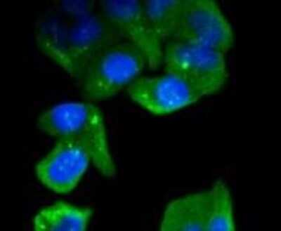 Immunocytochemistry/Immunofluorescence: CEBP Beta Antibody (SC55-05) [NBP2-67635] - Staining C/EBP Beta in Hela cells (green). The nuclear counter stain is DAPI (blue). Cells were fixed in paraformaldehyde, permeabilised with 0.25% Triton X100/PBS.