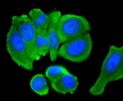 Immunocytochemistry/Immunofluorescence: CEBP Beta Antibody (SC55-05) [NBP2-67635] - Staining C/EBP Beta in MCF-7 cells (green). The nuclear counter stain is DAPI (blue). Cells were fixed in paraformaldehyde, permeabilised with 0.25% Triton X100/PBS.