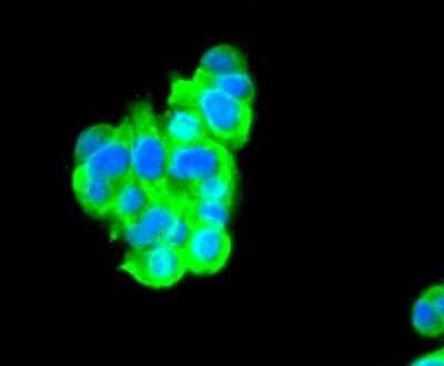Immunocytochemistry/Immunofluorescence: CEBP Beta Antibody (SC55-05) [NBP2-67635] - Staining C/EBP Beta in PC-12 cells (green). The nuclear counter stain is DAPI (blue). Cells were fixed in paraformaldehyde, permeabilised with 0.25% Triton X100/PBS.