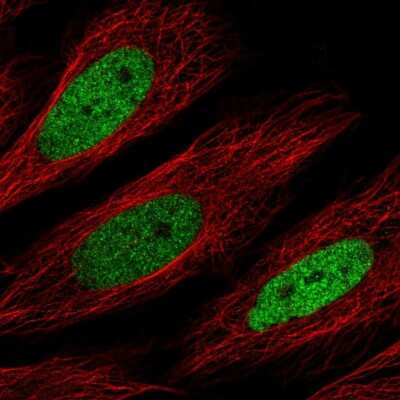 Immunocytochemistry/Immunofluorescence: CEBP Delta Antibody [NBP2-56564] - Staining of human cell line SiHa shows localization to nucleoplasm. Antibody staining is shown in green.