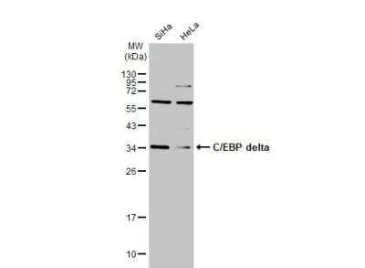 Western Blot: CEBP Delta Antibody [NBP2-21568] - Various whole cell extracts (30 ug) were separated by 12% SDS-PAGE, and the membrane was blotted with C/EBP delta antibody [N1C3] diluted at 1:500. The HRP-conjugated anti-rabbit IgG antibody (NBP2-19301) was used to detect the primary antibody.