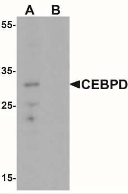 Western Blot: CEBP Delta Antibody [NBP2-41192] - Western blot analysis of CEBPD in rat spleen tissue lysate with CEBPD antibody at 0.5 ug/mL in (A) the absence and (B) the presence of blocking peptide.